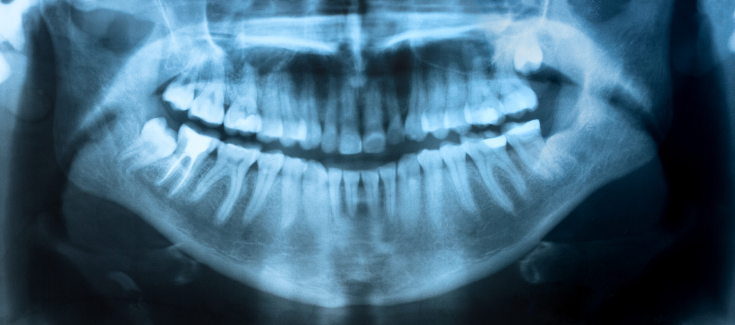 The Complex Story Of Teeth Solving Mysteries With Dental Records And 